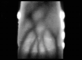 finger vein